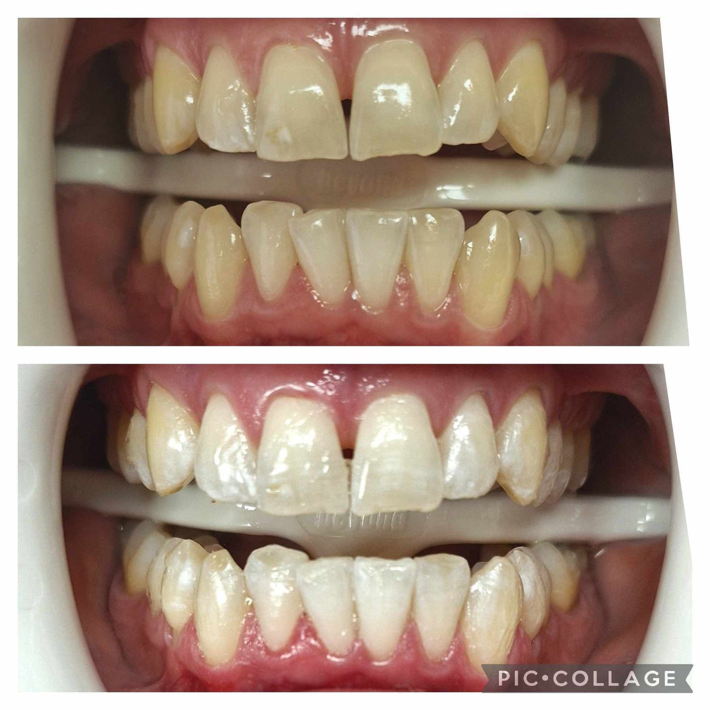 Signature Deluxe Treatment