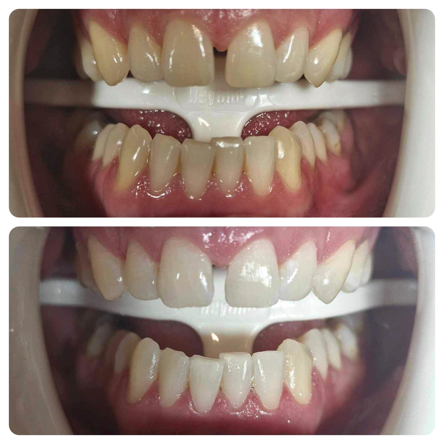 Signature Deluxe Treatment