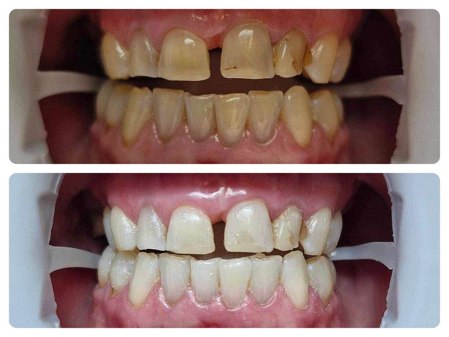 Signature Deluxe Treatment